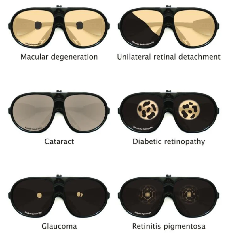 Simulation of eye diseases